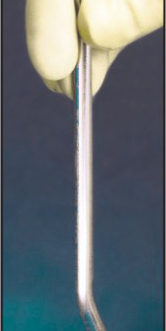 C008.72	 DEFLAGRATING /COMBUSTION SPOON